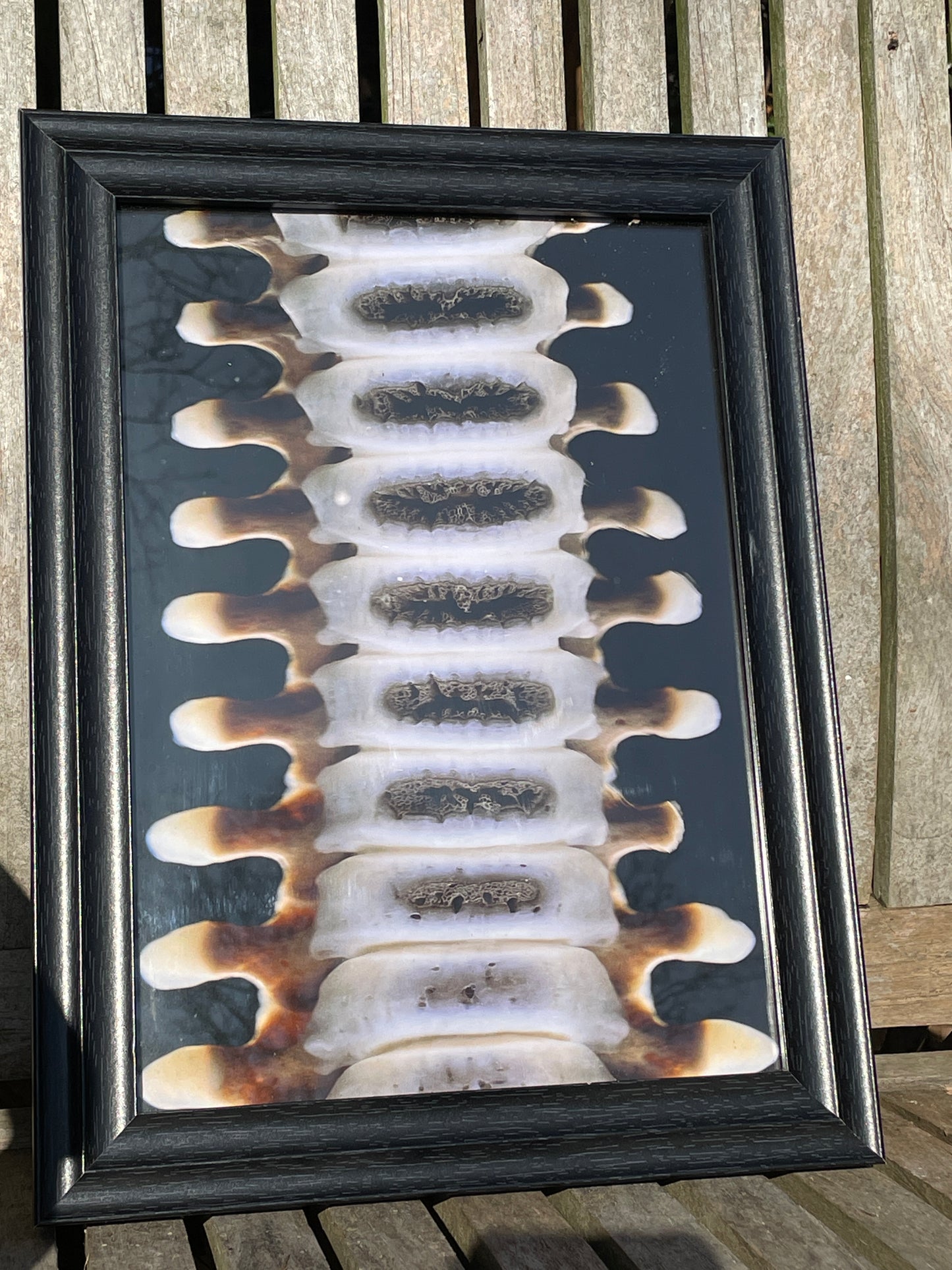 Anatomical prints of images of a spine from curios collector James Cranfield UK