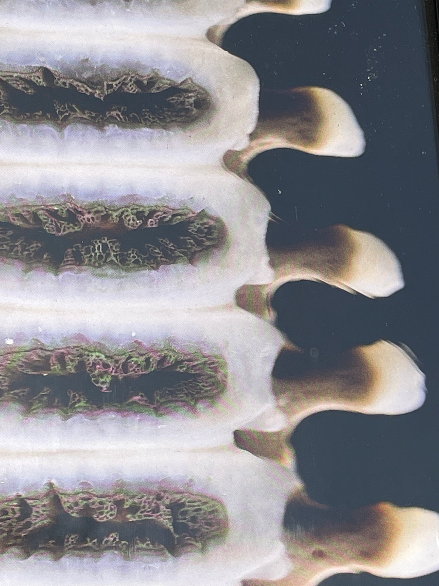 Anatomical prints of images of a spine from curios collector James Cranfield UK