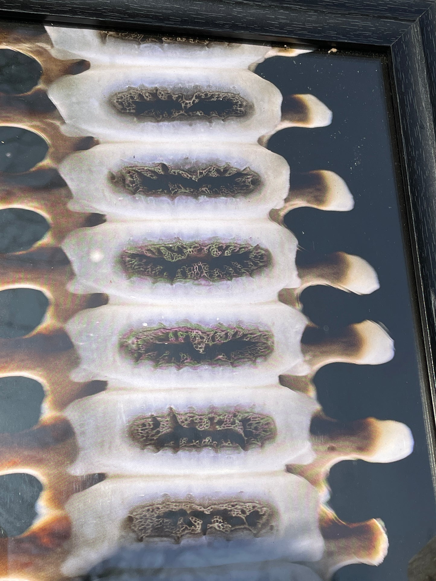 Anatomical prints of images of a spine from curios collector James Cranfield UK