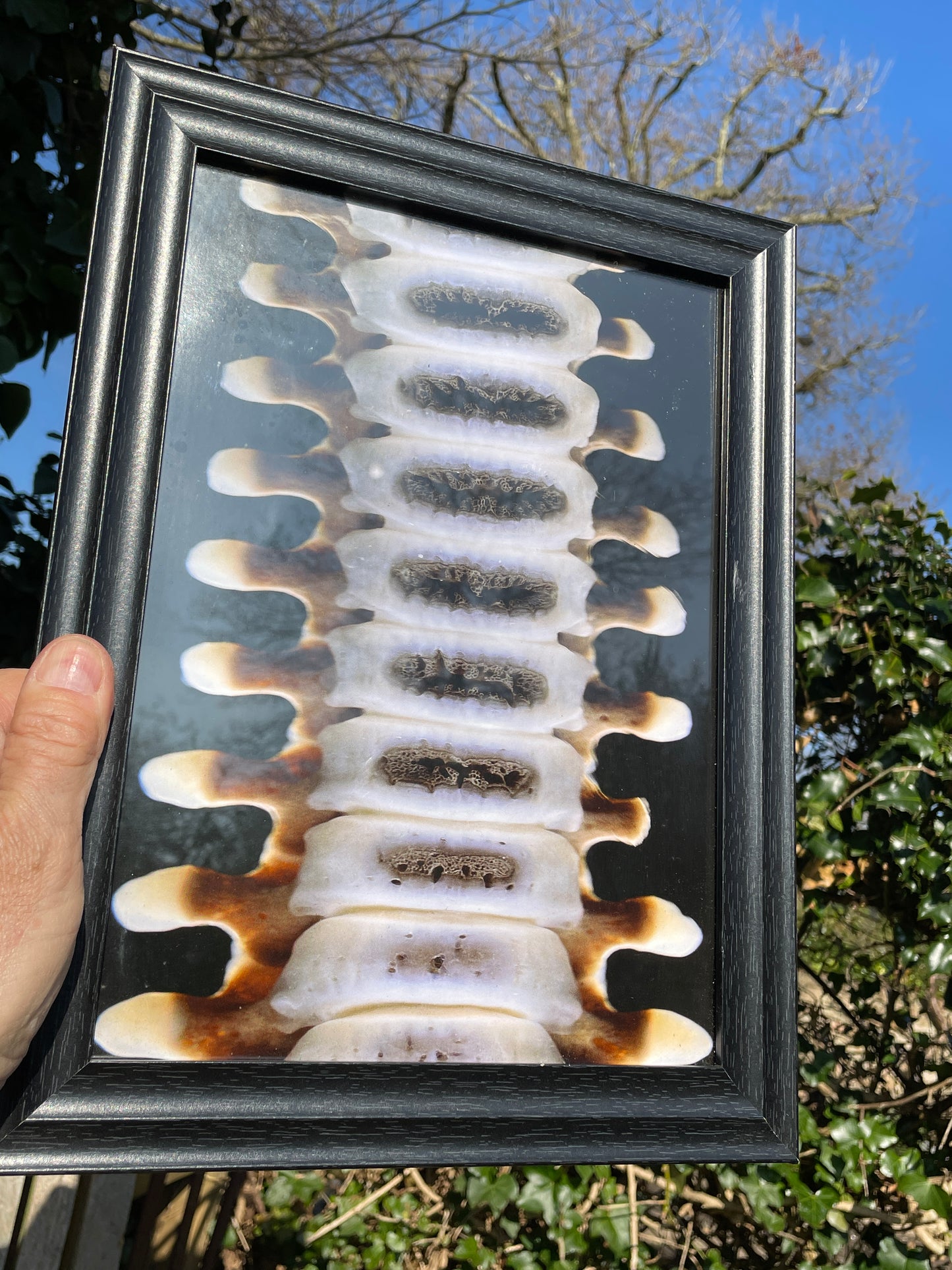 Anatomical prints of images of a spine from curios collector James Cranfield UK