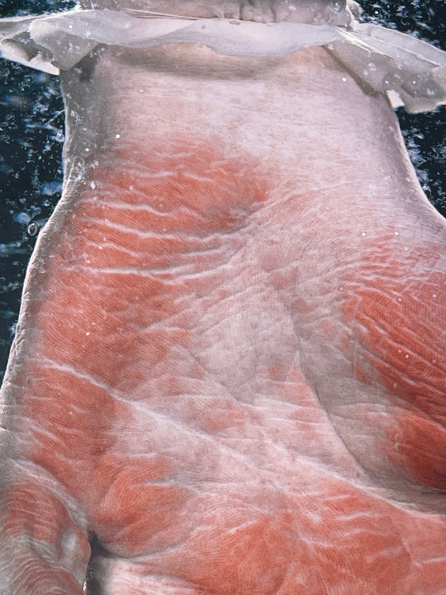Anatomical print of photograph of an 18th century hand  from curios collector James Cranfield UK