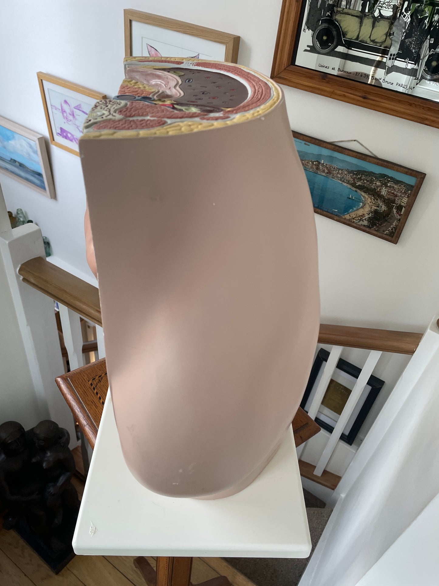 Vintage Medical Teaching Model – Pregnant Female Anatomy with Removable Foetus Childbirth Model