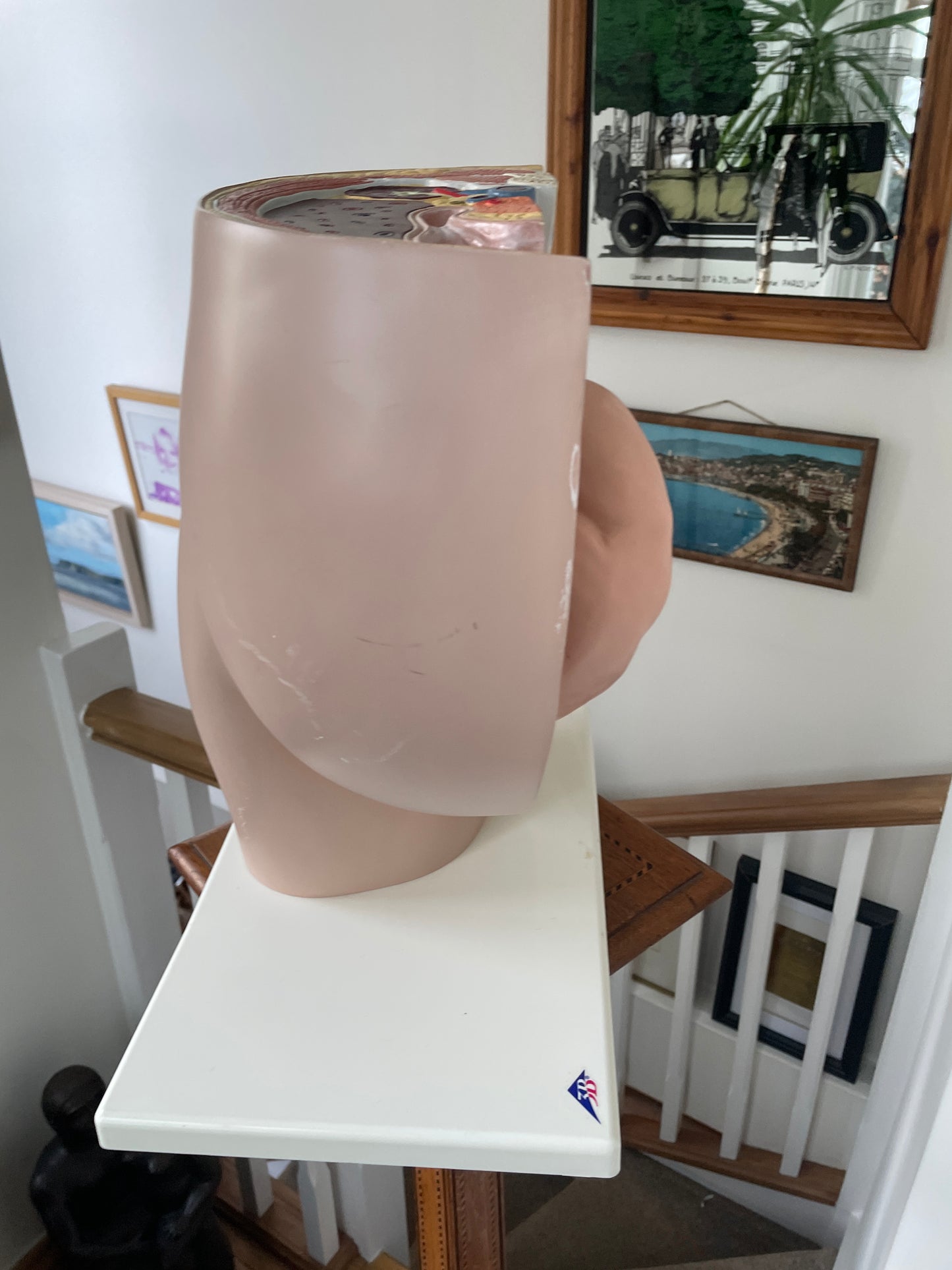 Vintage Medical Teaching Model – Pregnant Female Anatomy with Removable Foetus Childbirth Model