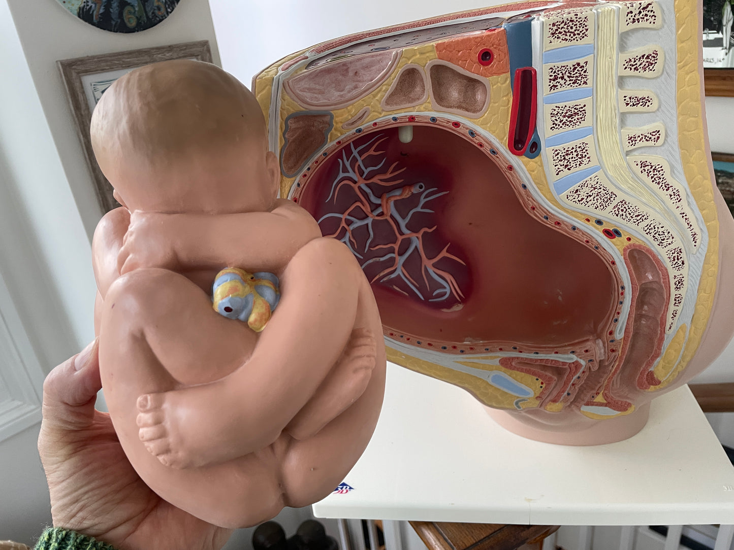 Vintage Medical Teaching Model – Pregnant Female Anatomy with Removable Foetus Childbirth Model