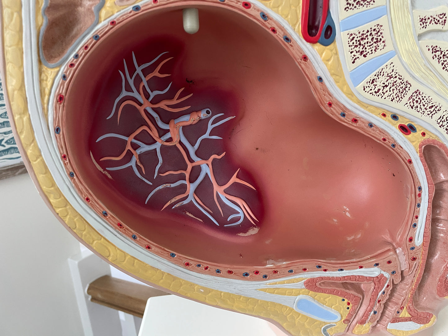 Vintage Medical Teaching Model – Pregnant Female Anatomy with Removable Foetus Childbirth Model