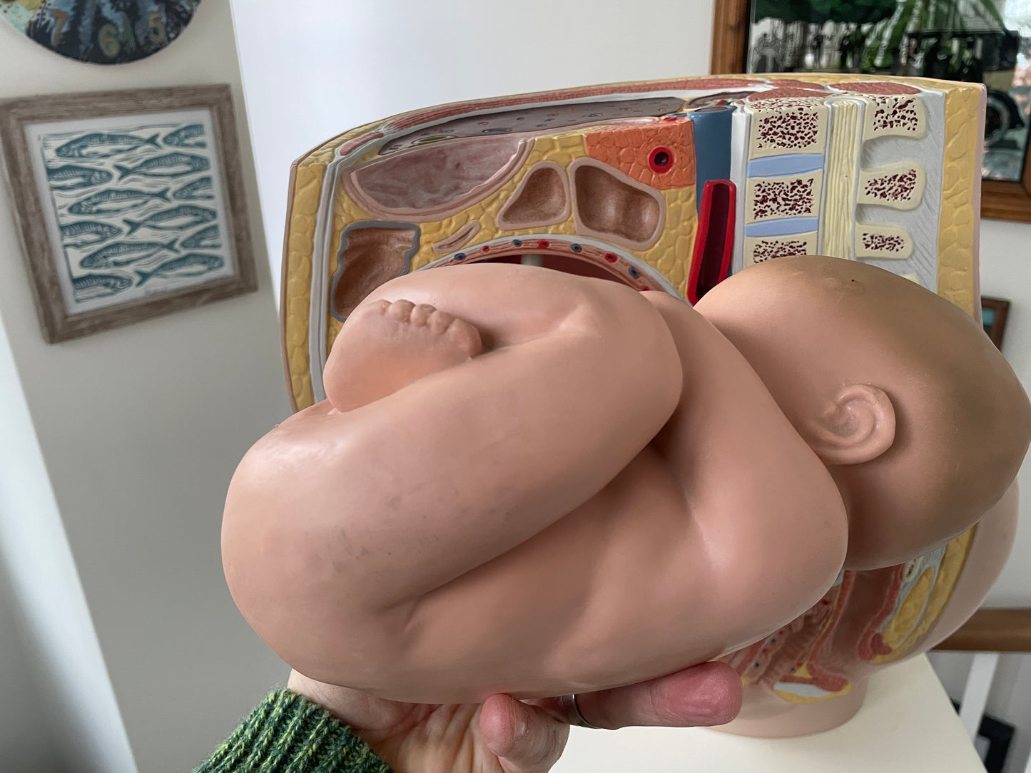 Vintage Medical Teaching Model – Pregnant Female Anatomy with Removable Foetus Childbirth Model