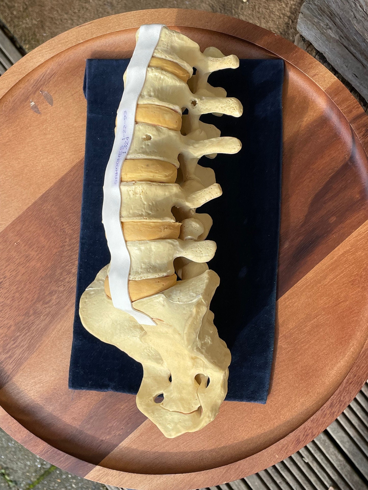 A human anatomical composite skeletal reference spine and hip teaching aid owned by Dr Paris Edwards who carried out first hip replacement