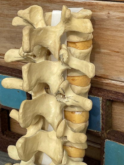 A human anatomical composite skeletal reference spine and hip teaching aid owned by Dr Paris Edwards who carried out first hip replacement