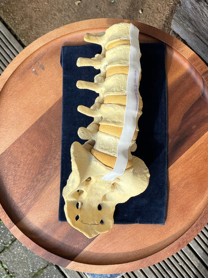 A human anatomical composite skeletal reference spine and hip teaching aid owned by Dr Paris Edwards who carried out first hip replacement